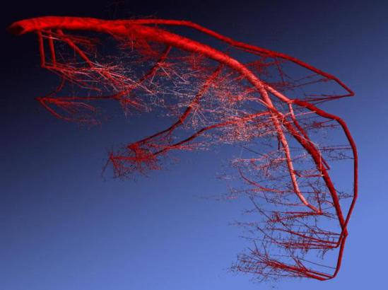 vessel-tree-large-bckg5